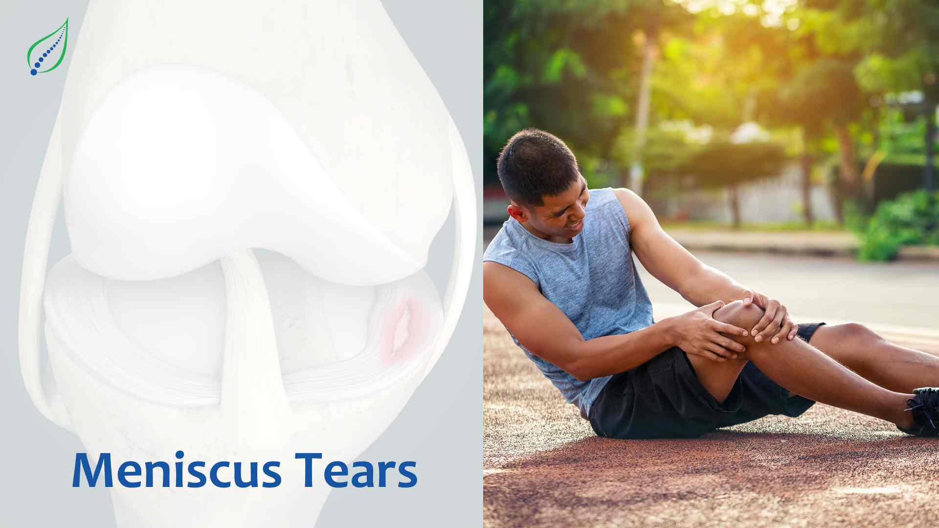 Understanding Meniscus Tears: Causes, Symptoms, and Treatment Options
